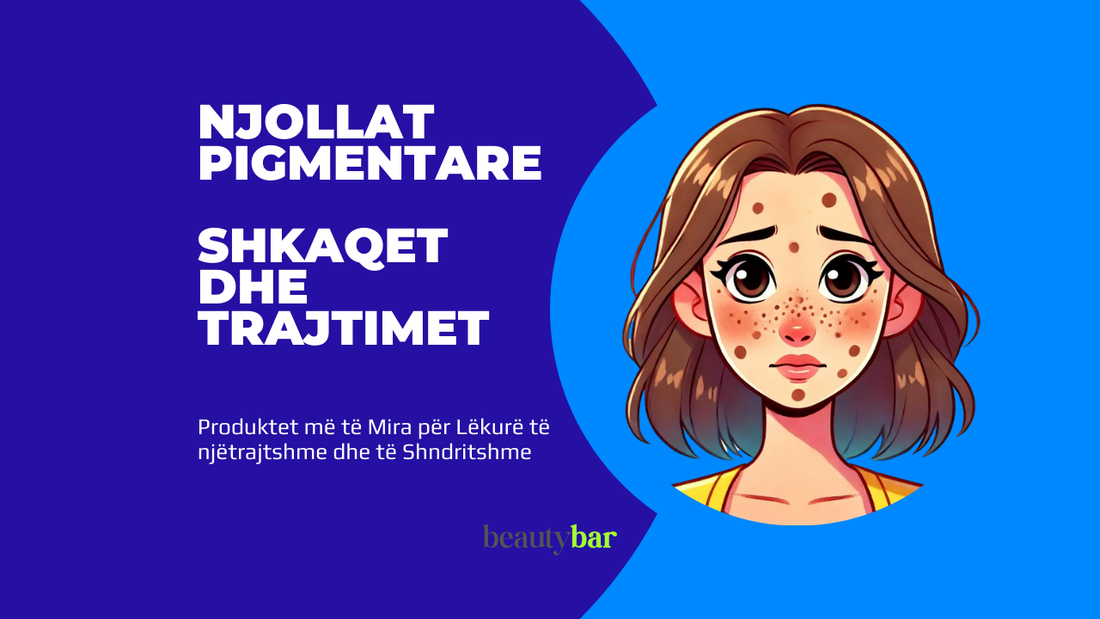 Njollat Pigmentare – Shkaqet dhe Trajtimet
